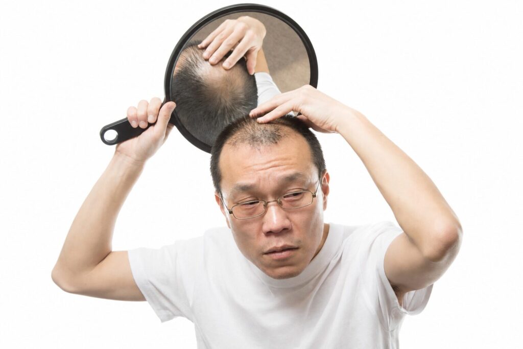 鏡で薄毛の進行を確認しながら疲れた表情を浮かべる中高年男性の画像