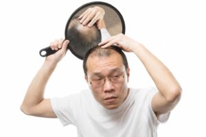 鏡で薄毛の進行を確認しながら疲れた表情を浮かべる中高年男性の画像